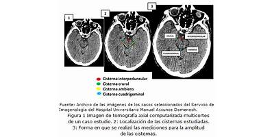 Altue