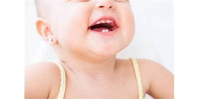 Dientecitos de Leche